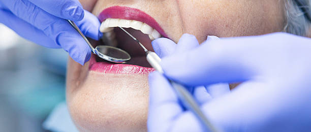 Best Emergency Root Canal Therapy in Glenwood, MN